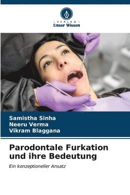 Parodontale Furkation und ihre Bedeutung 1