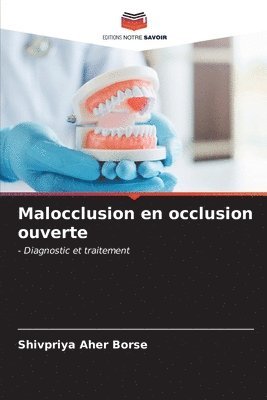 bokomslag Malocclusion en occlusion ouverte