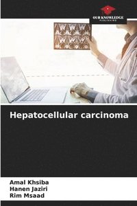 bokomslag Hepatocellular carcinoma