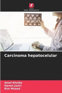 bokomslag Carcinoma hepatocelular