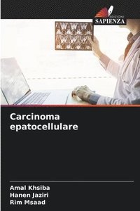 bokomslag Carcinoma epatocellulare