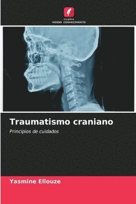 Traumatismo craniano 1