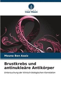 bokomslag Brustkrebs und antinuklere Antikrper