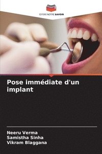 bokomslag Pose immdiate d'un implant