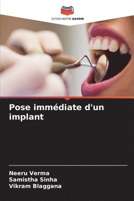 Pose immdiate d'un implant 1