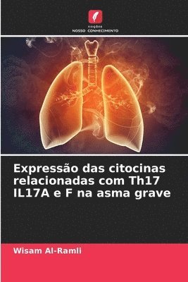 Expresso das citocinas relacionadas com Th17 IL17A e F na asma grave 1
