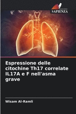 Espressione delle citochine Th17 correlate IL17A e F nell'asma grave 1