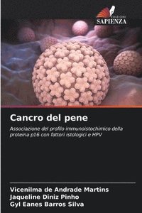 bokomslag Cancro del pene