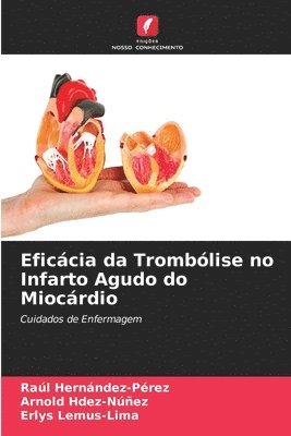 Eficcia da Tromblise no Infarto Agudo do Miocrdio 1