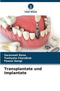 bokomslag Transplantate und Implantate