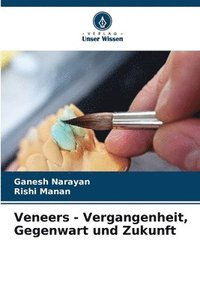 bokomslag Veneers - Vergangenheit, Gegenwart und Zukunft