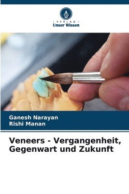 Veneers - Vergangenheit, Gegenwart und Zukunft 1