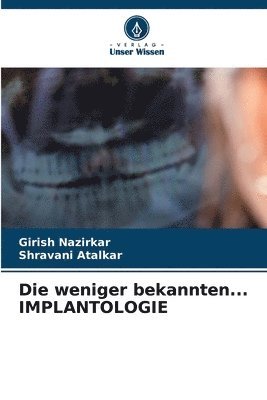 bokomslag Die weniger bekannten... IMPLANTOLOGIE