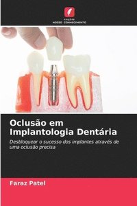 bokomslag Ocluso em Implantologia Dentria