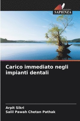 Carico immediato negli impianti dentali 1