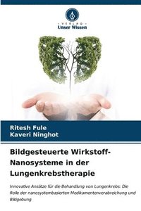 bokomslag Bildgesteuerte Wirkstoff-Nanosysteme in der Lungenkrebstherapie