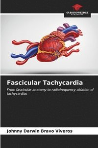 bokomslag Fascicular Tachycardia