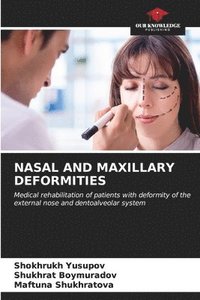 bokomslag Nasal and Maxillary Deformities