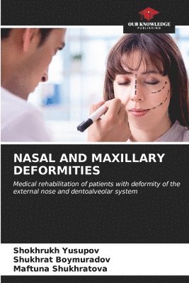 Nasal and Maxillary Deformities 1