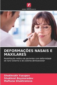 bokomslag Deformaes Nasais E Maxilares