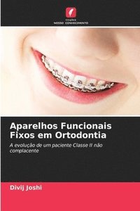 bokomslag Aparelhos Funcionais Fixos em Ortodontia