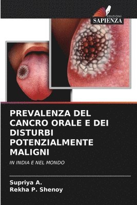 Prevalenza del Cancro Orale E Dei Disturbi Potenzialmente Maligni 1