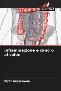 bokomslag Infiammazione e cancro al colon