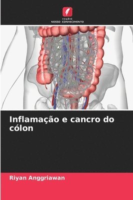 bokomslag Inflamao e cancro do clon