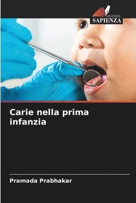 Carie nella prima infanzia 1