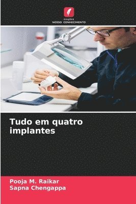 Tudo em quatro implantes 1