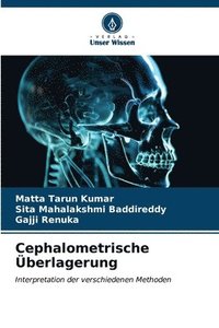 bokomslag Cephalometrische berlagerung