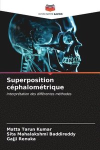 bokomslag Superposition cphalomtrique