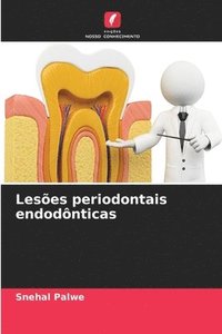 bokomslag Leses periodontais endodnticas