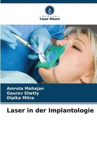bokomslag Laser in der Implantologie