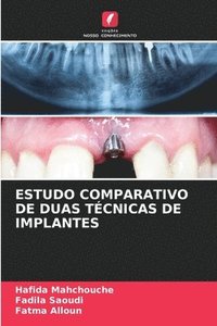 bokomslag Estudo Comparativo de Duas Tcnicas de Implantes
