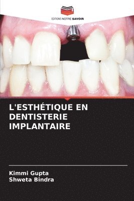 L'Esthtique En Dentisterie Implantaire 1