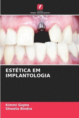 Esttica Em Implantologia 1