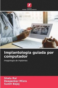 bokomslag Implantologia guiada por computador