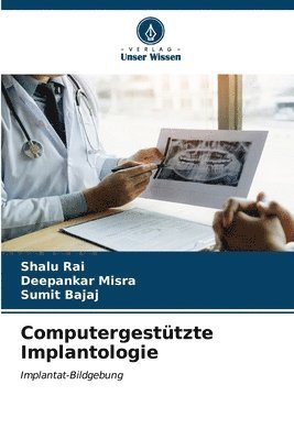 bokomslag Computergesttzte Implantologie