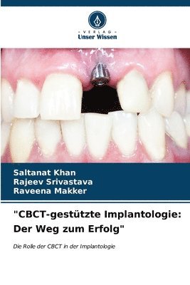 bokomslag &quot;CBCT-gesttzte Implantologie