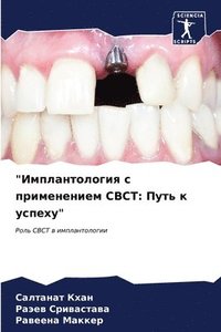 bokomslag &quot;&#1048;&#1084;&#1087;&#1083;&#1072;&#1085;&#1090;&#1086;&#1083;&#1086;&#1075;&#1080;&#1103; &#1089; &#1087;&#1088;&#1080;&#1084;&#1077;&#1085;&#1077;&#1085;&#1080;&#1077;&#1084; CBCT