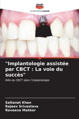 bokomslag &quot;Implantologie assiste par CBCT