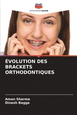 volution Des Brackets Orthodontiques 1