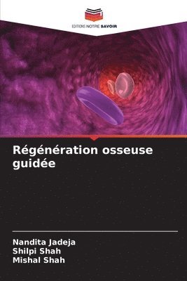 Rgnration osseuse guide 1