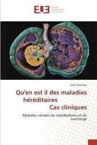 bokomslag Qu'en est il des maladies héréditaires Cas cliniques