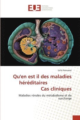 Qu'en est il des maladies hrditaires Cas cliniques 1