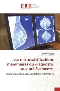 bokomslag Les microcalcifications mammaires du diagnostic aux prlvements