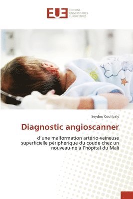Seydou Coulibaly - Diagnostic angioscanner, Häftad