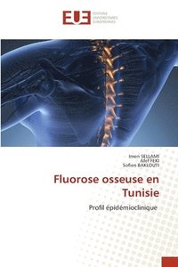 bokomslag Fluorose osseuse en Tunisie