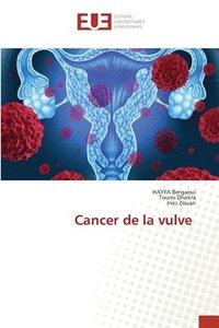 bokomslag Cancer de la vulve